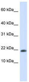 GATE-16 antibody, TA340174, Origene, Western Blot image 