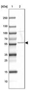 Crossover junction endonuclease MUS81 antibody, PA5-63743, Invitrogen Antibodies, Western Blot image 