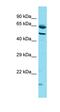 Rho-Type GTPase-Activating Protein 11B                     antibody, orb326841, Biorbyt, Western Blot image 