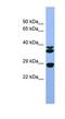 Fibroblast Growth Factor 3 antibody, NBP1-80503, Novus Biologicals, Western Blot image 