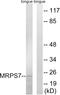 Mitochondrial Ribosomal Protein S7 antibody, A12749, Boster Biological Technology, Western Blot image 