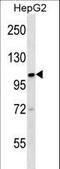Kinesin Family Member 18A antibody, LS-C165513, Lifespan Biosciences, Western Blot image 
