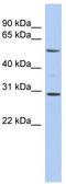 RELB Proto-Oncogene, NF-KB Subunit antibody, TA330069, Origene, Western Blot image 