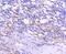 Tenascin C antibody, A00936-1, Boster Biological Technology, Immunohistochemistry paraffin image 