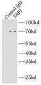 Antigen peptide transporter 1 antibody, FNab08499, FineTest, Immunoprecipitation image 