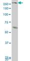 Histone-lysine N-methyltransferase, H3 lysine-36 and H4 lysine-20 specific antibody, H00064324-M08, Novus Biologicals, Western Blot image 