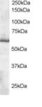 Thioredoxin Reductase 1 antibody, LS-B3926, Lifespan Biosciences, Western Blot image 