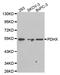 Pyruvate Dehydrogenase Complex Component X antibody, STJ24941, St John
