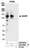 Double-stranded RNA-specific adenosine deaminase antibody, A303-883A, Bethyl Labs, Immunoprecipitation image 