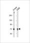 Peroxisomal acyl-coenzyme A oxidase 1 antibody, M03054, Boster Biological Technology, Western Blot image 
