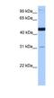 Saccharopine Dehydrogenase (Putative) antibody, NBP1-60126, Novus Biologicals, Western Blot image 