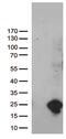 Ubiquitin Conjugating Enzyme E2 N Like (Gene/Pseudogene) antibody, M16722, Boster Biological Technology, Western Blot image 