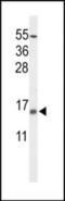 Potassium Voltage-Gated Channel Subfamily E Regulatory Subunit 5 antibody, orb314748, Biorbyt, Western Blot image 