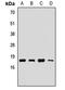 Ubiquitin Conjugating Enzyme E2 G2 antibody, orb411762, Biorbyt, Western Blot image 