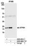 ATP Synthase Peripheral Stalk Subunit D antibody, A305-491A, Bethyl Labs, Immunoprecipitation image 