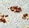 Adenovirus antibody, ab76550, Abcam, Immunohistochemistry paraffin image 