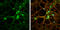 Discs Large MAGUK Scaffold Protein 2 antibody, GTX133244, GeneTex, Immunocytochemistry image 