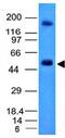 Carbonic Anhydrase 9 antibody, orb388793, Biorbyt, Western Blot image 