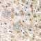 Aspartyl-TRNA Synthetase antibody, A6574, ABclonal Technology, Immunohistochemistry paraffin image 
