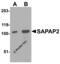 DLG Associated Protein 2 antibody, 4625, ProSci, Western Blot image 