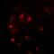 Negative Elongation Factor Complex Member E antibody, abx141529, Abbexa, Western Blot image 