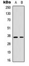 Cyclin H antibody, GTX55052, GeneTex, Western Blot image 