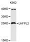 LHFPL Tetraspan Subfamily Member 2 antibody, LS-C747877, Lifespan Biosciences, Western Blot image 