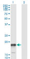 Prostate Stem Cell Antigen antibody, LS-C139342, Lifespan Biosciences, Western Blot image 