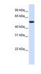 mRNA-decapping enzyme 2 antibody, NBP1-57441, Novus Biologicals, Western Blot image 