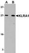 T-cell surface glycoprotein YE1/48 antibody, orb75129, Biorbyt, Western Blot image 