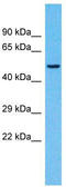 Cancer Susceptibility 4 antibody, TA333438, Origene, Western Blot image 