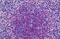 Protein Kinase D2 antibody, MBS246567, MyBioSource, Immunohistochemistry paraffin image 