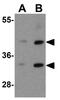 Killer cell immunoglobulin-like receptor 2DS2 antibody, GTX31949, GeneTex, Western Blot image 