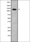 ADAM Metallopeptidase With Thrombospondin Type 1 Motif 2 antibody, orb337971, Biorbyt, Western Blot image 