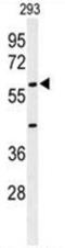 Anti-Mullerian Hormone antibody, AP50161PU-N, Origene, Western Blot image 