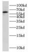 Far upstream element-binding protein 3 antibody, FNab03236, FineTest, Western Blot image 