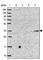 Beta-1,4-Galactosyltransferase 2 antibody, HPA047739, Atlas Antibodies, Western Blot image 