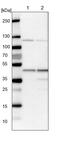 Hydroxymethylbilane Synthase antibody, PA5-52253, Invitrogen Antibodies, Western Blot image 