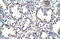 Heterogeneous nuclear ribonucleoprotein M antibody, orb324880, Biorbyt, Immunohistochemistry paraffin image 