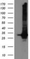 Glutathione S-Transferase Theta 2 (Gene/Pseudogene) antibody, NBP2-03126, Novus Biologicals, Western Blot image 