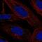 Lamin Tail Domain Containing 2 antibody, NBP2-56567, Novus Biologicals, Immunocytochemistry image 