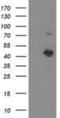 STN1 Subunit Of CST Complex antibody, NBP2-01006, Novus Biologicals, Western Blot image 