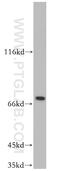 Pre-mRNA-splicing factor SLU7 antibody, 12050-1-AP, Proteintech Group, Western Blot image 