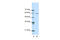 AT-Rich Interaction Domain 3A antibody, 27-729, ProSci, Western Blot image 