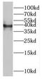 MAGE Family Member B4 antibody, FNab04943, FineTest, Western Blot image 