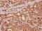 Quinolinate Phosphoribosyltransferase antibody, LS-C681153, Lifespan Biosciences, Immunohistochemistry paraffin image 
