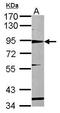 HMMR antibody, PA5-31870, Invitrogen Antibodies, Western Blot image 