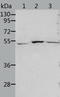 Aldehyde Dehydrogenase 3 Family Member B1 antibody, TA323583, Origene, Western Blot image 