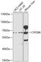 Cytochrome P450 2B6 antibody, GTX64899, GeneTex, Western Blot image 