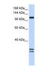 NCK Associated Protein 1 Like antibody, NBP1-79231, Novus Biologicals, Western Blot image 